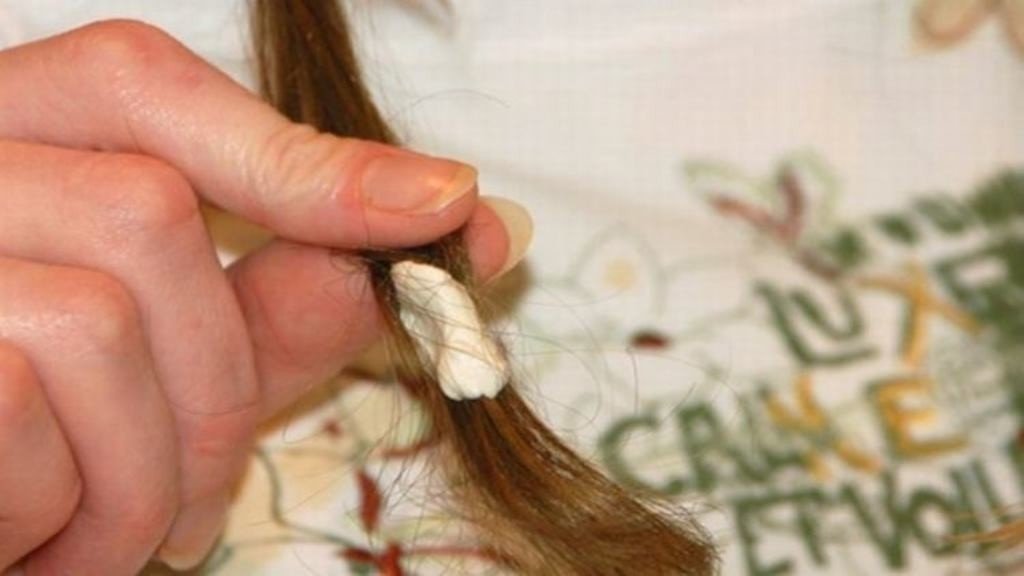Чем убрать жвачку с волос у ребенка